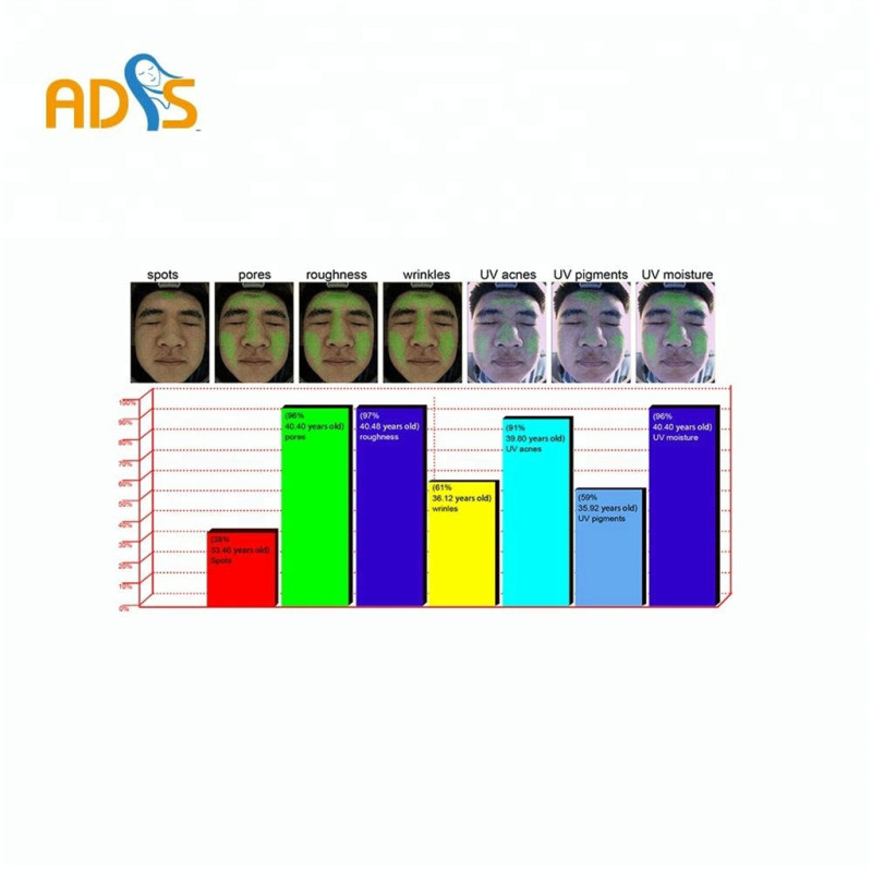 Professional 3d skin analyzer for skin care