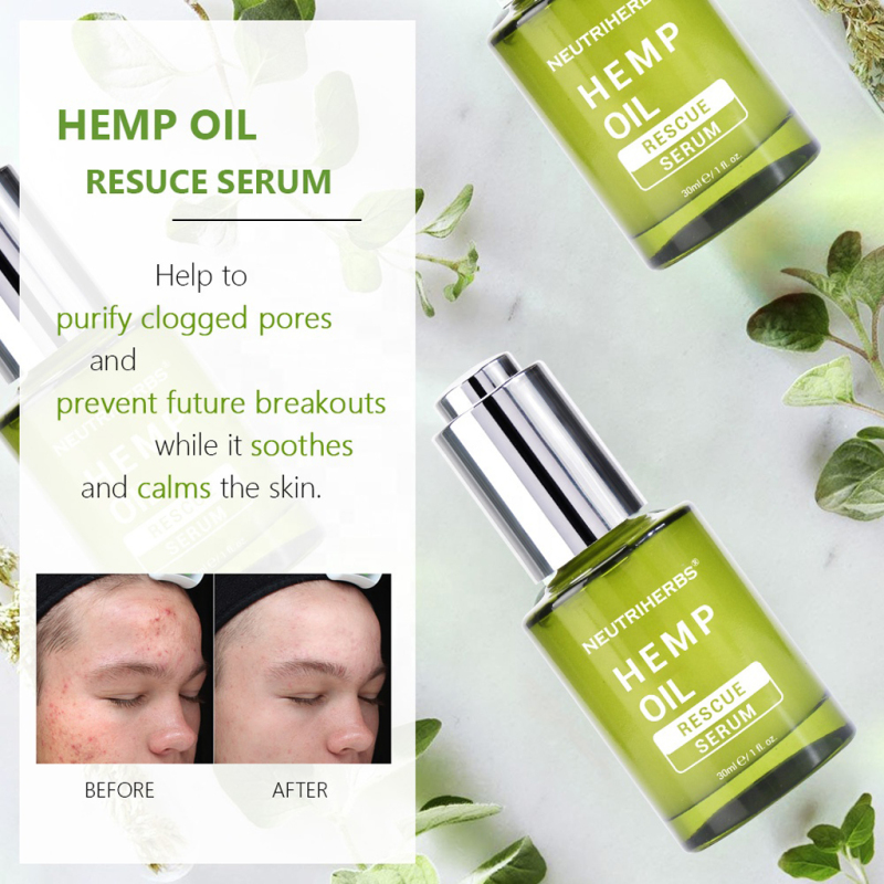 Neutriherbs Hemp Oil Rescue Serum For Acne-prone Skin