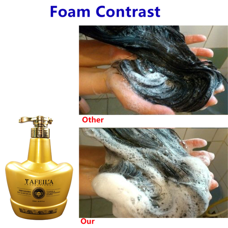 550ml Shampoo for Oily Hair & Oily Scalp Natural Dandruff Treatment for Women & Men Hair Support OEM and ODM 