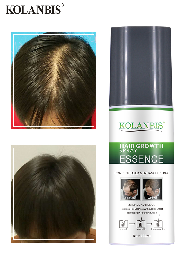 Hair loss treatment product help hair growth