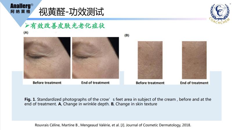 Factory Supply Cosmetic Grade Retinal Yellow Powder High Purity 99% CAS 116-31-4