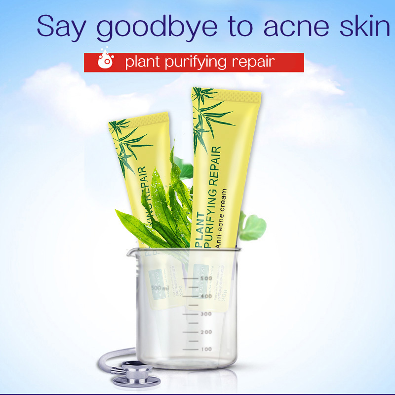 Beauty Host Plant Extract Facial anti - acne cream