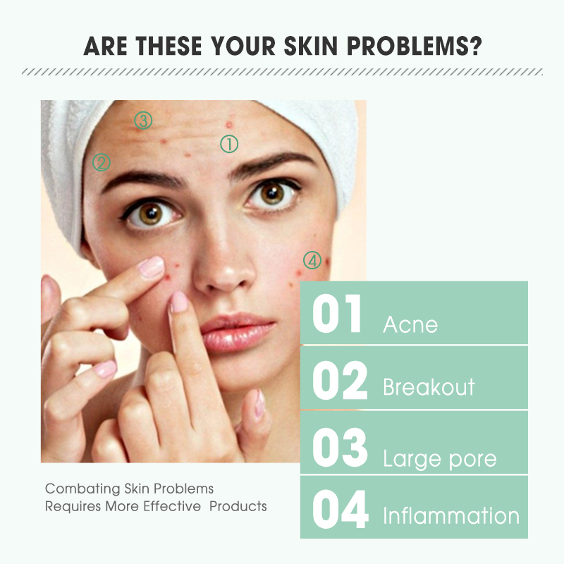 Anti Acne Remover Vitamin C Sodium Hyaluronic Salicylic Acid Skin Care Repairing Ampoule Face Serum