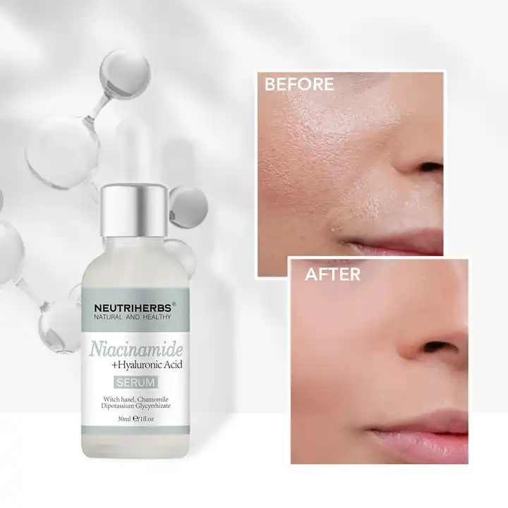 Skin Care Anti Aging Serum Ordinary Whitening Facial Niacinamide Hyaluronic Acid Serum 30Ml Vitamin C Skin Care Serum for Face