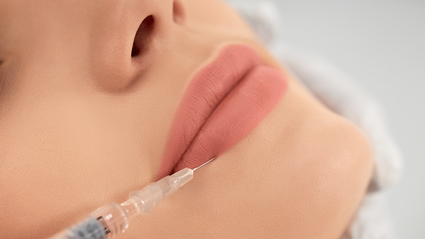 What Are Cosmetic Fillers
