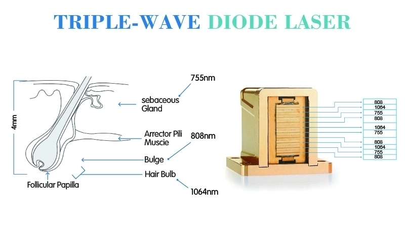 Effective Triple-Wave Diode Laser Hair Removal Machine
