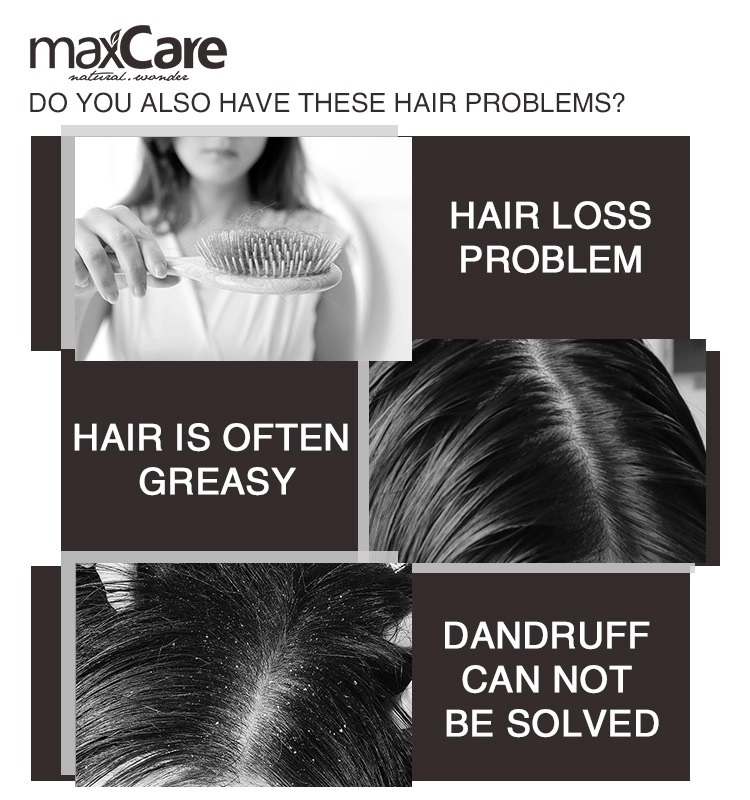Anti Dandruff ginger hair growth shampoo hair conditioner