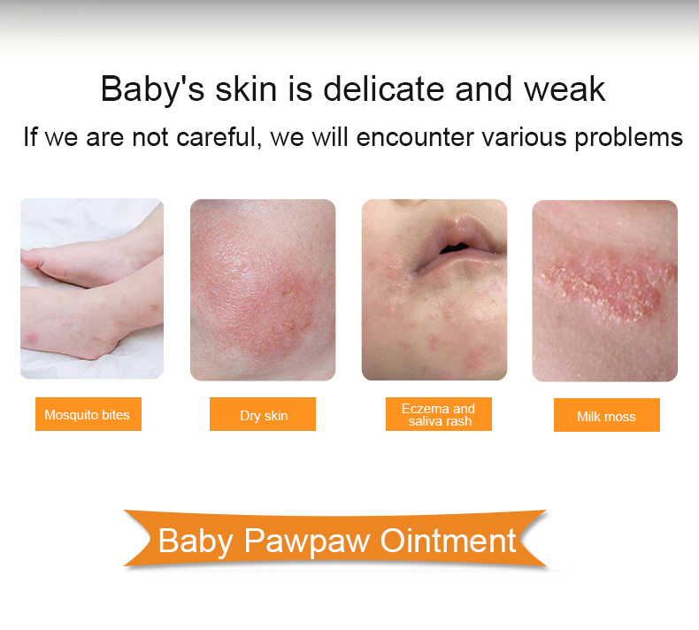 Baby Pawpaw Ointment