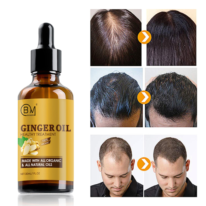 anti hair loss serum private label hair growth oil